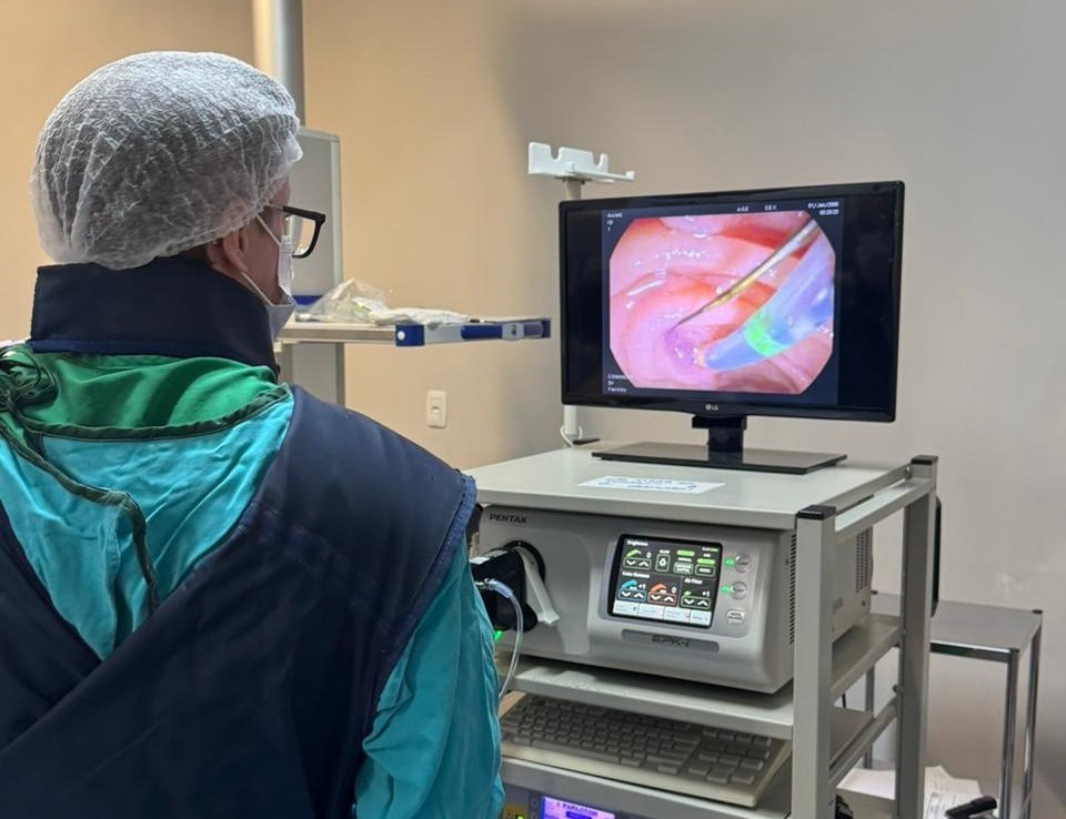 O Hospital Santa Terezinha de Erechim ultrapassou, em março de 2026, a marca de 100 procedimentos de Colangiopancreatografia Retrógrada Endoscópica (CPRE) realizados pelo Sistema Único de Saúde (SUS), ampliando o acesso da população a um tratamento de alta complexidade. A CPRE é um procedimento indicado principalmente para tratar obstruções nas vias biliares, como cálculos e tumores. Realizada por endoscopia associada a radioscopia, sem cortes externos, a técnica permite intervenções menos invasivas, com recuperação mais rápida e menor risco de complicações.